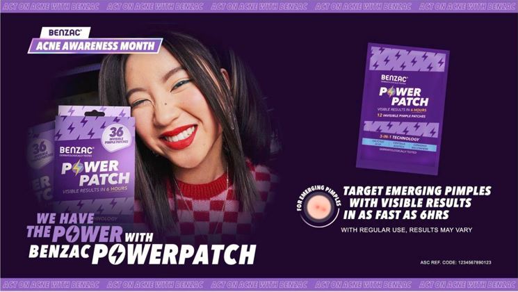 Clear It Up: Benzac Steals the Spotlight This Acne Awareness Month 2025